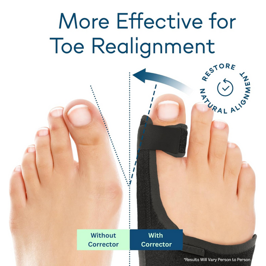 Hyggear Bunion Corrector for Women & Men, Orthopedic Bunion Splint for Hallux Valgus Pain Relief, Big Toe Separator, Adjustable Day/Night Support, Comfortable Hammer Toe Straightener
