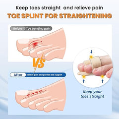 Hyggear™ Hammer Toe Straightener Splint Brace