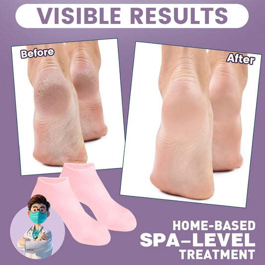 Hyggear Moisturizing Socks [Corn & Callus Care]
