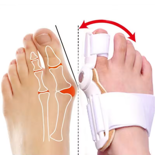 Hyggear Hallux Valgus (Bunion) Corrector