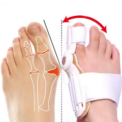 Hyggear Hallux Valgus (Bunion) Corrector