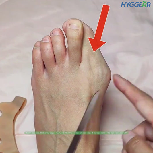 Hyggear Double Toe Separator: Special Bundle Offer